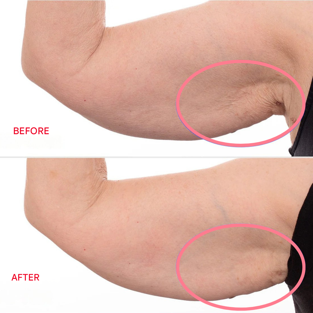 Firming and Toning Arm Cream