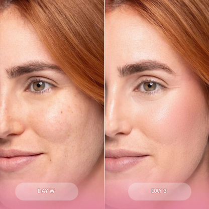Bio-Collagen Mask Reduces Wrinkles by 75% after just 1 application