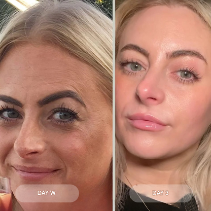 Bio-Collagen Mask Reduces Wrinkles by 75% after just 1 application
