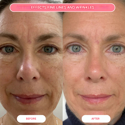 Organic Collagen Salmon Mask (Box of 4 Masks)