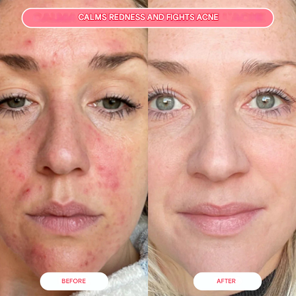 Organic Collagen Salmon Mask (Box of 4 Masks)