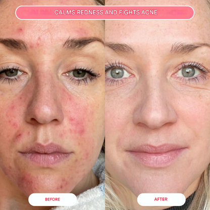 Organic Collagen Salmon Mask (Box of 4 Masks)