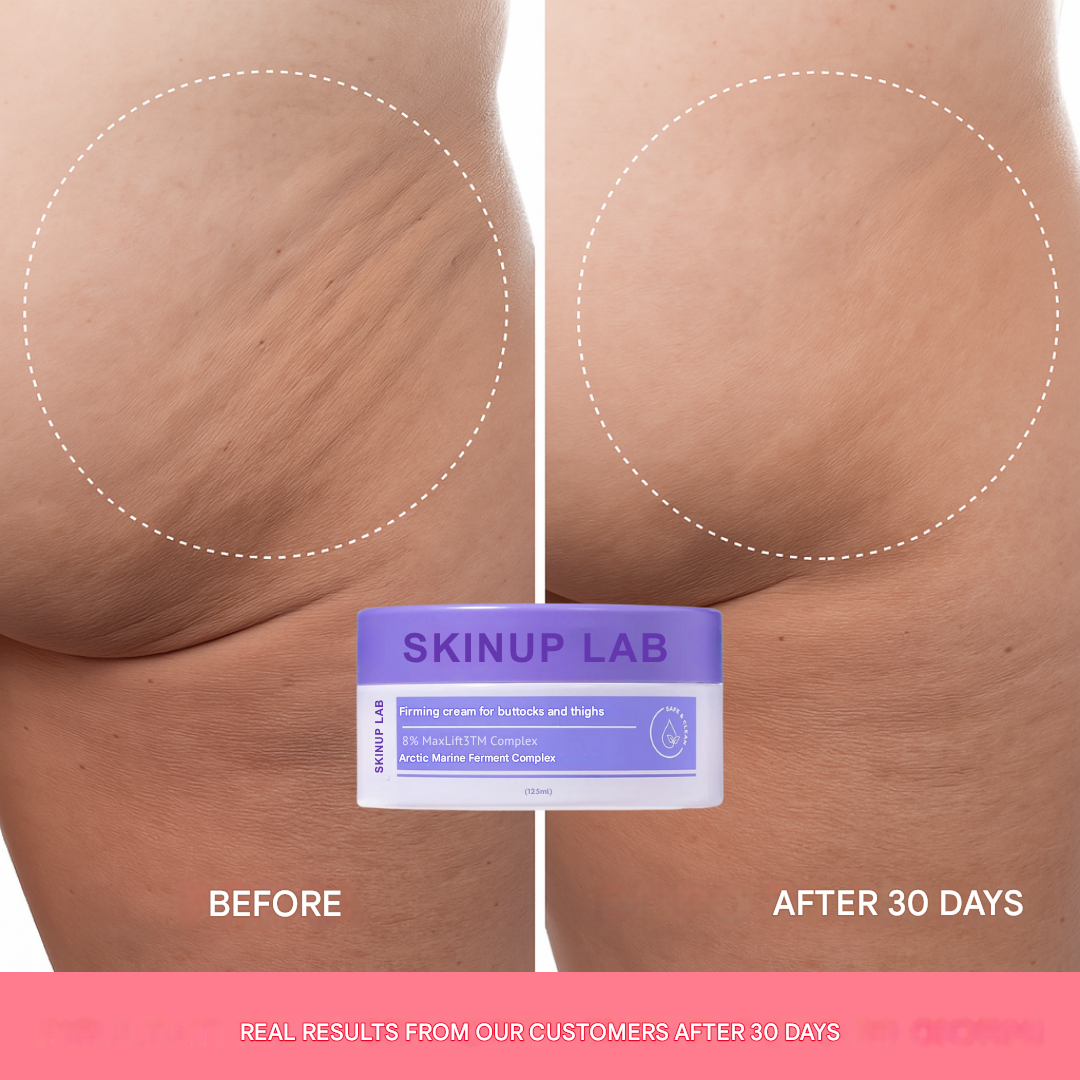 Firming cream for buttocks and thighs