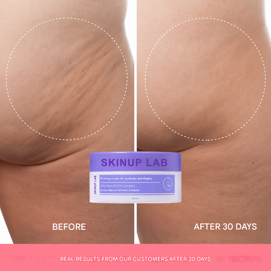 Firming cream for buttocks and thighs